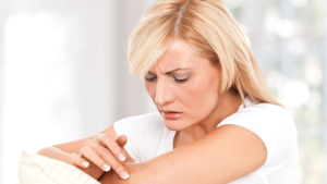 dry skin in winter