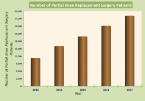 Partial knee replacement